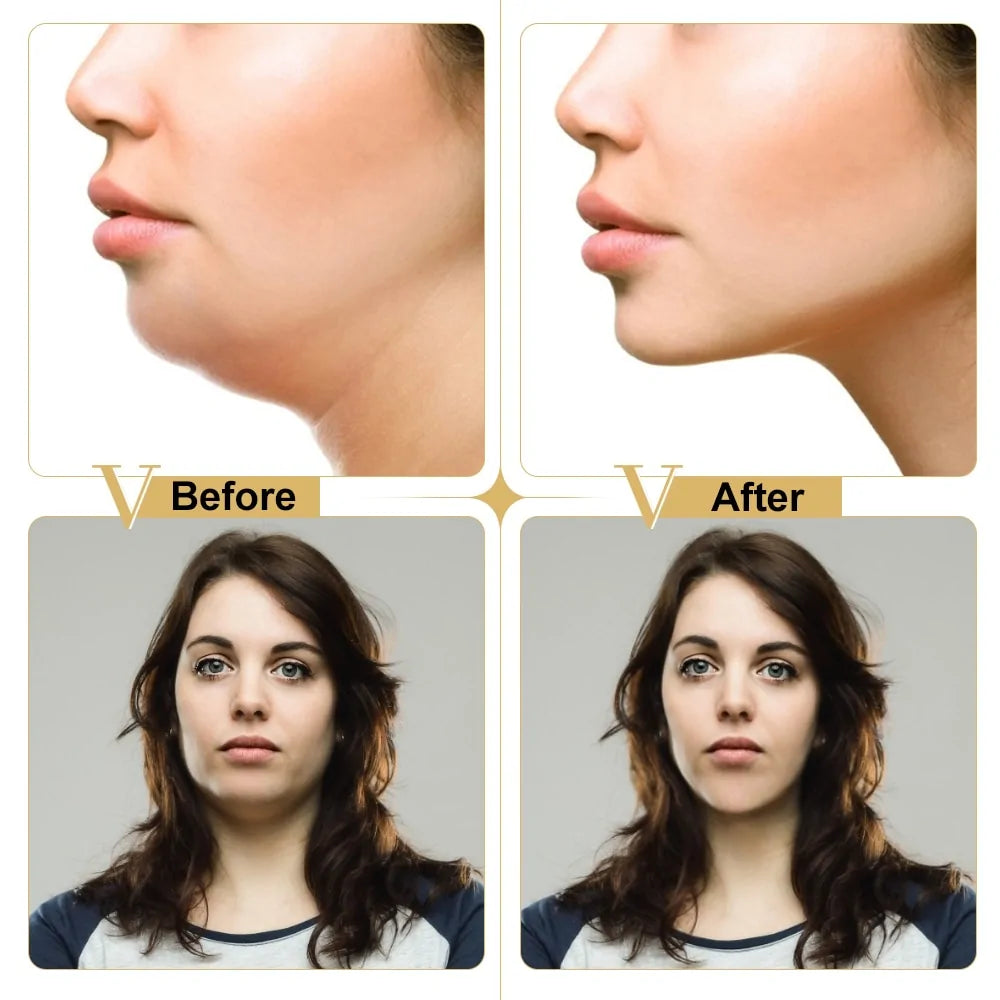 Face Lifting V Shape Slimming Mask